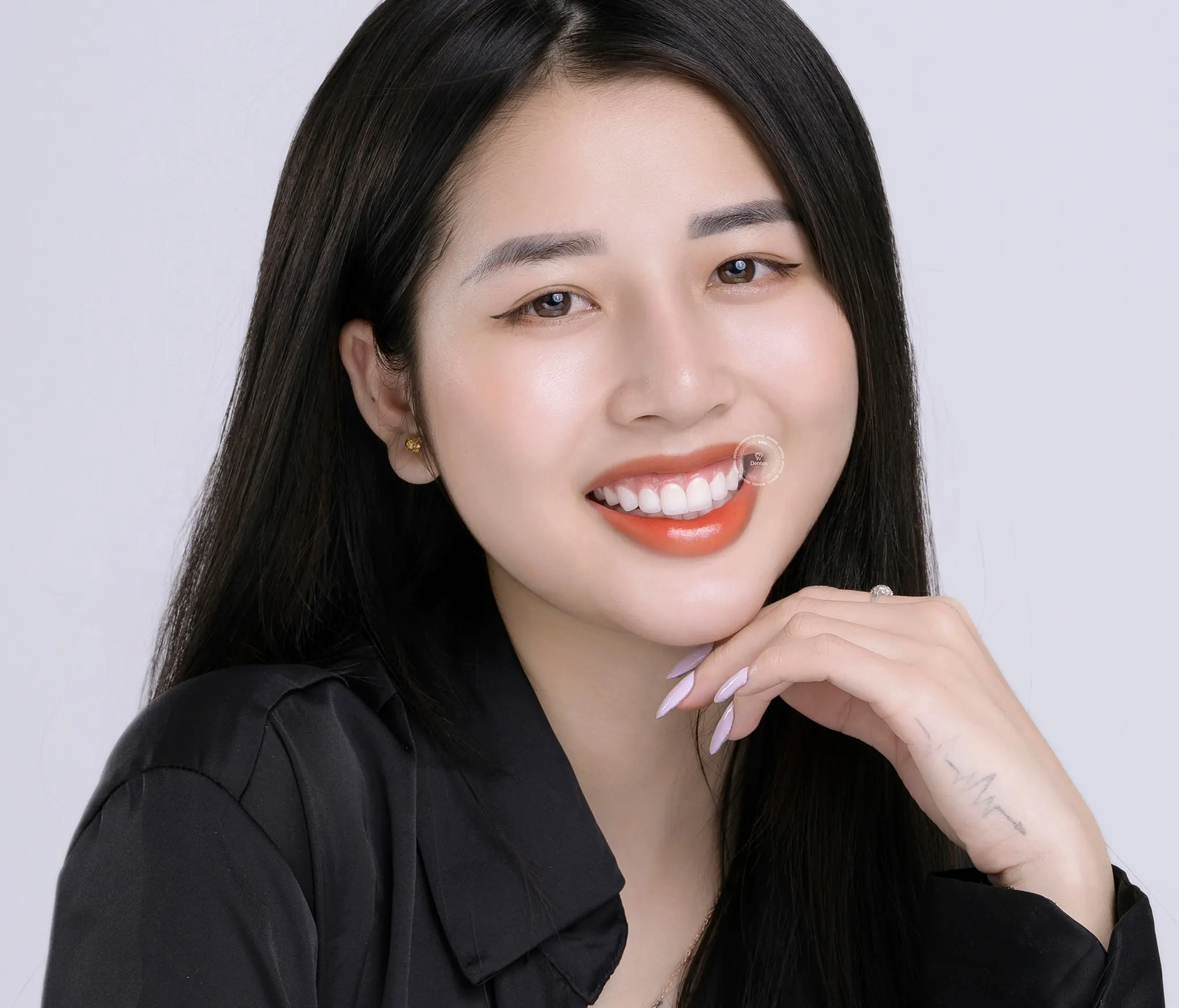 Hãy đến nha khoa Dentos để tìm ra giải pháp tối ưu khi bị sâu răng